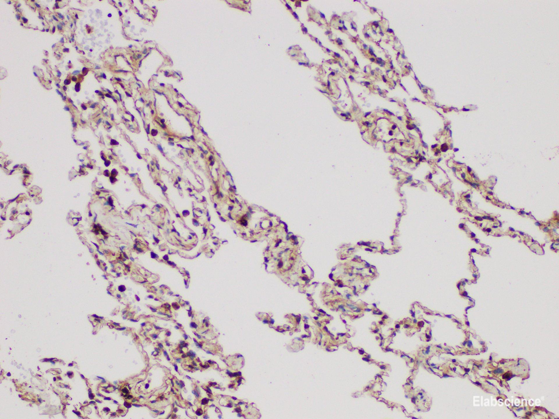 Immunohistochemistry of paraffin-embedded Human lung using DMBT1 Polycloanl Antibody at dilution of 1:300