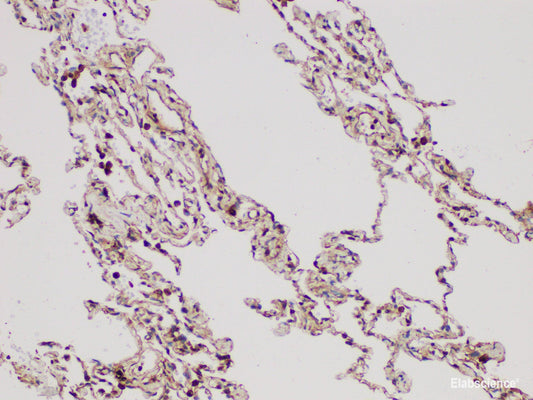 Immunohistochemistry of paraffin-embedded Human lung using DMBT1 Polycloanl Antibody at dilution of 1:300