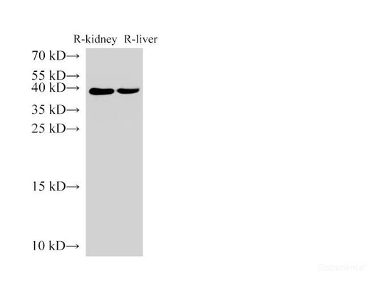 Western Blot analysis of Rat kidney and Rat liver using AMACR Polyclonal Antibody at dilution of 1:3000.
