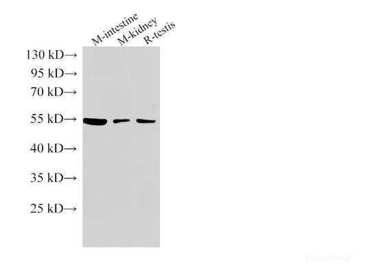Western Blot analysis of Mouse intestine, Mouse kidney and Rat testis using beta Tubulin Polyclonal Antibody at dilution of 1:1000.