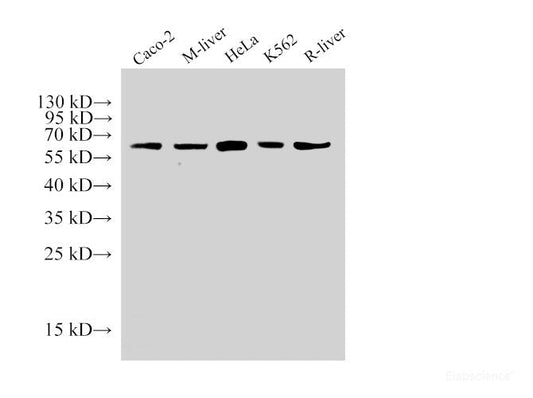 Western Blot analysis of 1)Caco-2, 2)Mouse liver, 3)Hela, 4)K562, 5)Rat liver using HSP60 Polyclonal Antibody at dilution of 1:2000