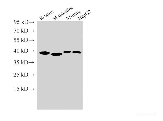 Western Blot analysis of Rat brain, Mouse intestine, Mouse lung and HepG2 cells using TBP Polyclonal Antibody at dilution of 1:5000.