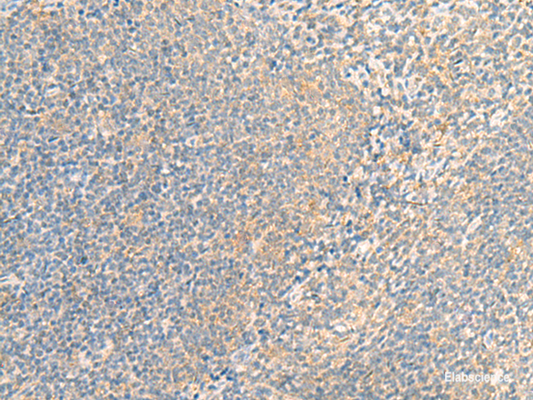 Immunohistochemistry of paraffin-embedded Human tonsil tissue  using IFNA5 Polyclonal Antibody at dilution of 1:35(×200)