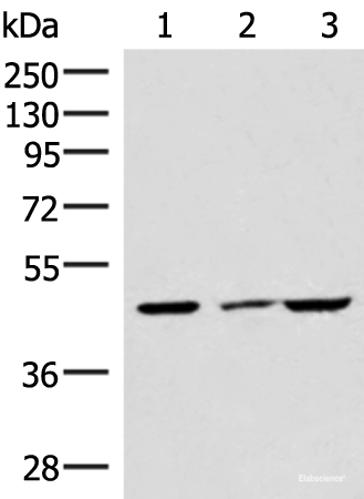 Western blot analysis of HUVEC cell Mouse brain tissue and A549 cell lysates  using IP6K2 Polyclonal Antibody at dilution of 1:550