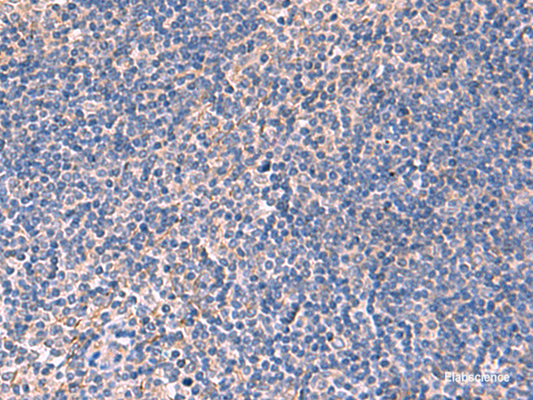 Immunohistochemistry of paraffin-embedded Human tonsil tissue  using INPP5B Polyclonal Antibody at dilution of 1:40(×200)