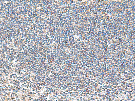 Immunohistochemistry of paraffin-embedded Human tonsil tissue  using IFNA2 Polyclonal Antibody at dilution of 1:40(×200)