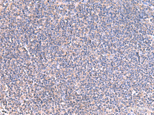Immunohistochemistry of paraffin-embedded Human tonsil tissue  using GRIA2 Polyclonal Antibody at dilution of 1:40(×200)