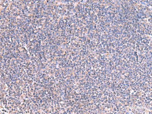 Immunohistochemistry of paraffin-embedded Human tonsil tissue  using GRIA2 Polyclonal Antibody at dilution of 1:40(×200)