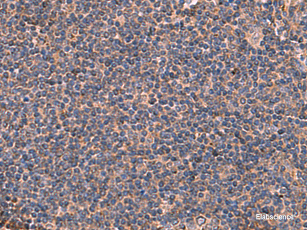 Immunohistochemistry of paraffin-embedded Human tonsil tissue  using ITGA11 Polyclonal Antibody at dilution of 1:50(×200)
