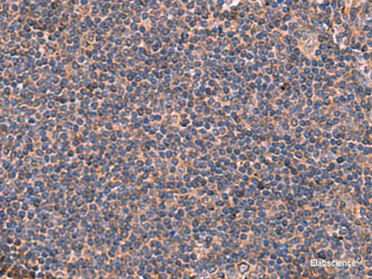 Immunohistochemistry of paraffin-embedded Human tonsil tissue  using ITGA11 Polyclonal Antibody at dilution of 1:50(×200)
