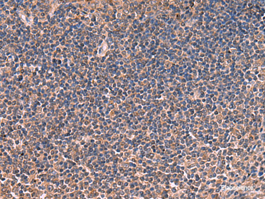 Immunohistochemistry of paraffin-embedded Human tonsil tissue  using ITIH4 Polyclonal Antibody at dilution of 1:30(×200)