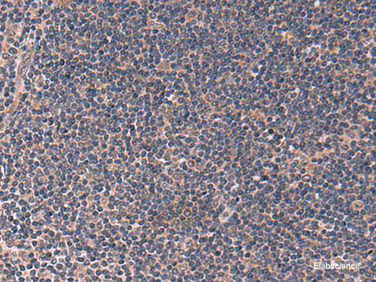Immunohistochemistry of paraffin-embedded Human tonsil tissue  using ITPR2 Polyclonal Antibody at dilution of 1:60(×200)