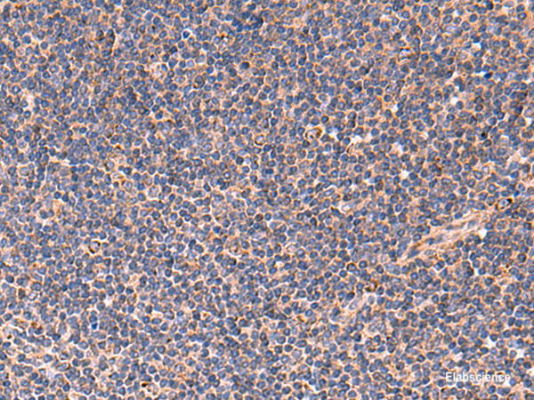 Immunohistochemistry of paraffin-embedded Human tonsil tissue  using TNF Polyclonal Antibody at dilution of 1:40(×200)