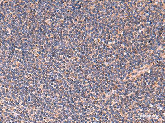 Immunohistochemistry of paraffin-embedded Human tonsil tissue  using TNF Polyclonal Antibody at dilution of 1:40(×200)