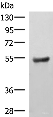 Western blot analysis of Human fetal brain tissue lysate  using KDM4D Polyclonal Antibody at dilution of 1:650