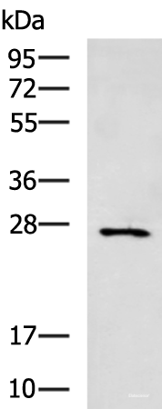 Western blot analysis of Mouse small intestines tissue lysate  using CIDEC Polyclonal Antibody at dilution of 1:400