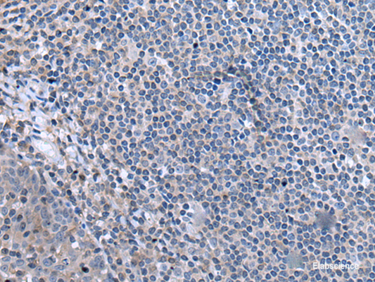 Immunohistochemistry of paraffin-embedded Human tonsil tissue  using CCK Polyclonal Antibody at dilution of 1:55. (Original magnific at ion: ×200) at dilution of 1:55(×200)
