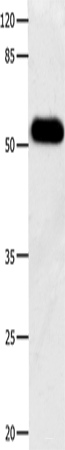 Western blot analysis of Human notum skin cancer tissue  using DOK3 Polyclonal Antibody at dilution of 1:500