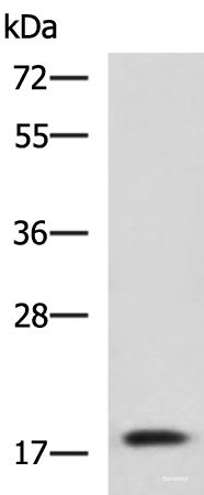 Western blot analysis of Human fetal liver tissue lysate  using IL1B Polyclonal Antibody at dilution of 1:800