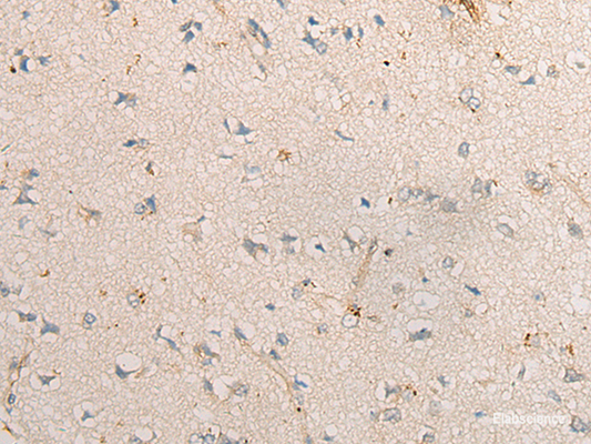 Immunohistochemistry of paraffin-embedded Human brain tissue  using PPM1D Polyclonal Antibody at dilution of 1:60(×200)