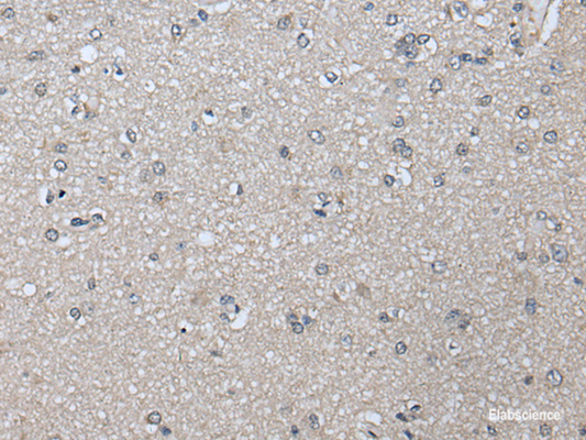 Immunohistochemistry of paraffin-embedded Human brain tissue  using PRAME Polyclonal Antibody at dilution of 1:65(×200)