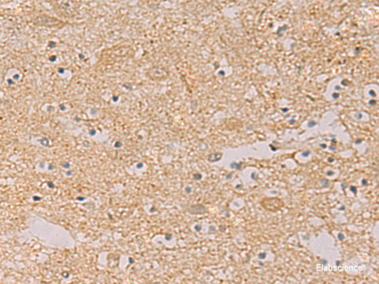 Immunohistochemistry of paraffin-embedded Human brain tissue  using PTPRN Polyclonal Antibody at dilution of 1:55(×200)