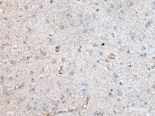 Immunohistochemistry of paraffin-embedded Human brain tissue  using RAB4A Polyclonal Antibody at dilution of 1:40(×200)