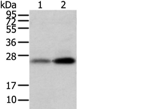 Western blot analysis of Mouse trachea and brain tissue  using WFDC5 Polyclonal Antibody at dilution of 1:1100
