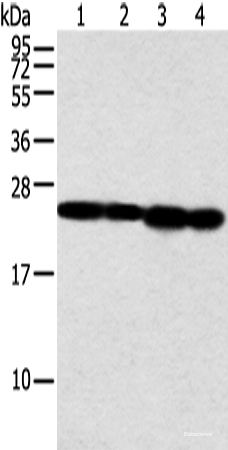 Western blot analysis of Jurkat and A549 cell human fetal liver tissue and hela cell  using NDUFB9 Polyclonal Antibody at dilution of 1:350
