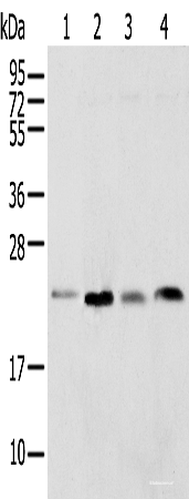 Western blot analysis of Rat lung tissue HT-29 cell Mouse adrenal gland tissue and K-562 cell  using SPCS2 Polyclonal Antibody at dilution of 1:450
