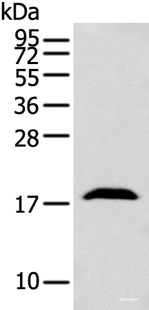 Western blot analysis of Mouse brain tissue  using GMFB Polyclonal Antibody at dilution of 1:250