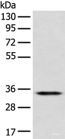 Western blot analysis of Jurkat cell  using CD1D Polyclonal Antibody at dilution of 1:300