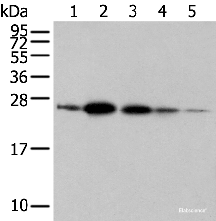 Western blot analysis of 293T A549 and 231 cell Human fetal brain tissue Human placenta tissue  using RAB11A Polyclonal Antibody at dilution of 1:500