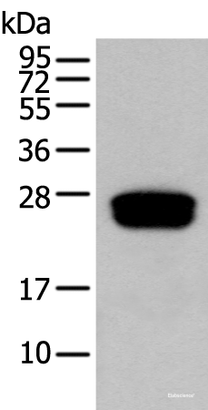 Western blot analysis of Human testis tissue  using GLIPR1L1 Polyclonal Antibody at dilution of 1:300