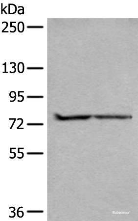 Western blot analysis of A549 and Jurkat cell lysates  using ALKBH8 Polyclonal Antibody at dilution of 1:300