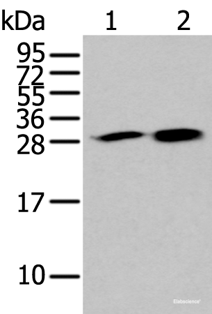 Western blot analysis of 293T and 231 cell lysates  using HDHD2 Polyclonal Antibody at dilution of 1:400