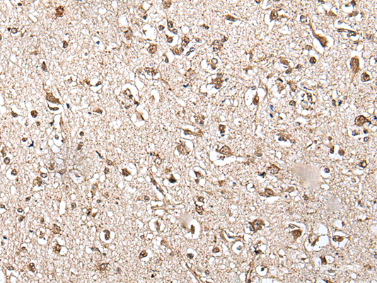 Immunohistochemistry of paraffin-embedded Human brain tissue  using ZFP36 Polyclonal Antibody at dilution of 1:55(×200)