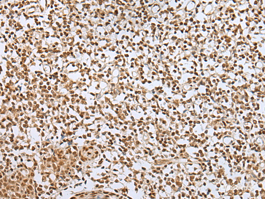 Immunohistochemistry of paraffin-embedded Human tonsil tissue  using ZNF354A Polyclonal Antibody at dilution of 1:40(×200)