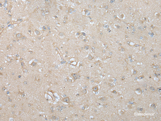 Immunohistochemistry of paraffin-embedded Human brain tissue  using VILL Polyclonal Antibody at dilution of 1:65(×200)