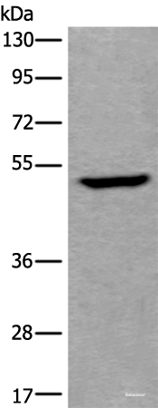 Western blot analysis of Human fetal liver tissue lysate  using UMPS Polyclonal Antibody at dilution of 1:400