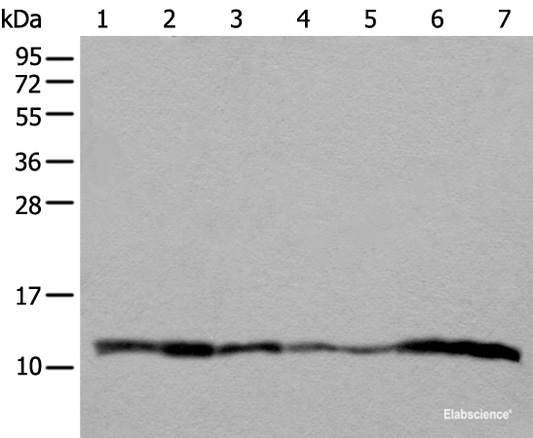 Western blot analysis of 293T A549 Hela and 231 cell Human placenta tissue HEPG2 cell Human fetal liver tissue lysates  using UQCRQ Polyclonal Antibody at dilution of 1:400