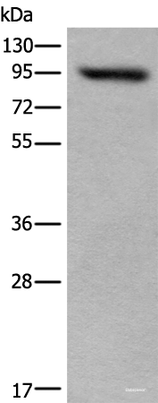 Western blot analysis of 293T cell lysate  using USP6NL Polyclonal Antibody at dilution of 1:400