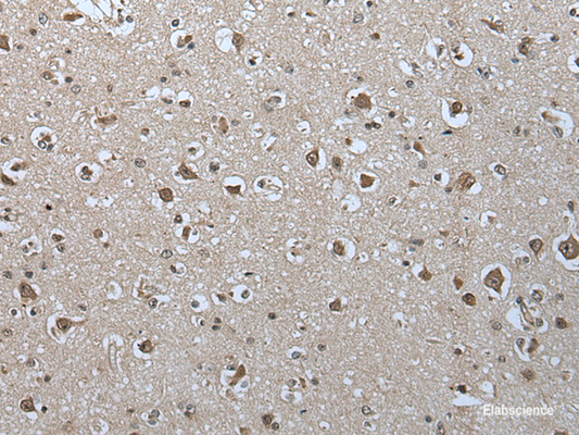 Immunohistochemistry of paraffin-embedded Human brain tissue  using USP35 Polyclonal Antibody at dilution of 1:55(×200)