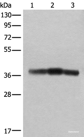 Western blot analysis of Rat brain tissue Mouse brain tissue and Human cerebrum tissue lysates  using ATAD1 Polyclonal Antibody at dilution of 1:800