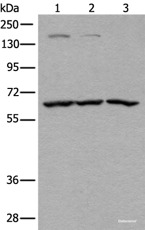 Western blot analysis of Raji Hela and A431 cell lysates  using ATAD3A Polyclonal Antibody at dilution of 1:400