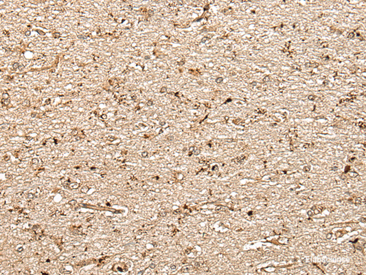Immunohistochemistry of paraffin-embedded Human brain tissue  using MCPH1 Polyclonal Antibody at dilution of 1:40(×200)