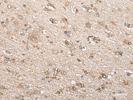 Immunohistochemistry of paraffin-embedded Human brain tissue  using BCHE Polyclonal Antibody at dilution of 1:60(×200)