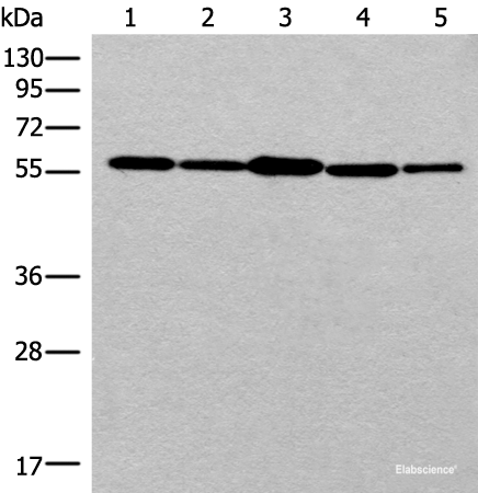 Western blot analysis of 293T cell HUVEC cell Hela cell lysates  using RAD23B Polyclonal Antibody at dilution of 1:350