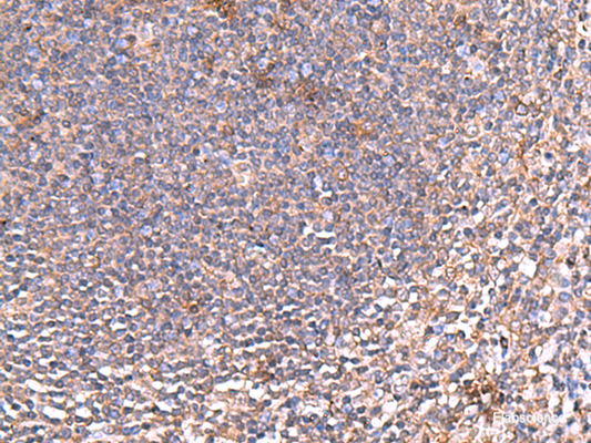Immunohistochemistry of paraffin-embedded Human tonsil tissue  using PDRG1 Polyclonal Antibody at dilution of 1:80(×200)
