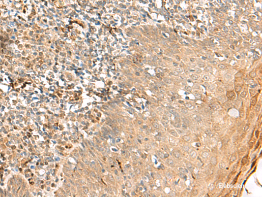 Immunohistochemistry of paraffin-embedded Human tonsil tissue  using ZNF397 Polyclonal Antibody at dilution of 1:45(×200)
